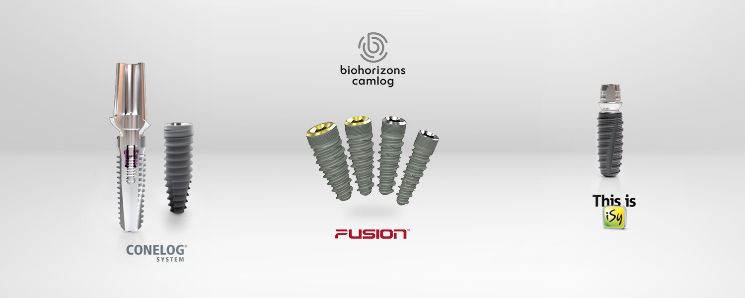 Slide Implants 1